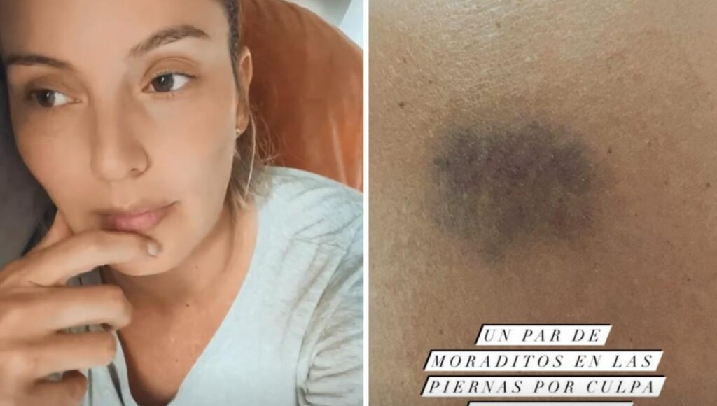 Claudia Bahamón fue atracada y arrastrada por asaltadores Claudia Bahamón fue atracada y arrastrada por asaltadores | RTA Noticias