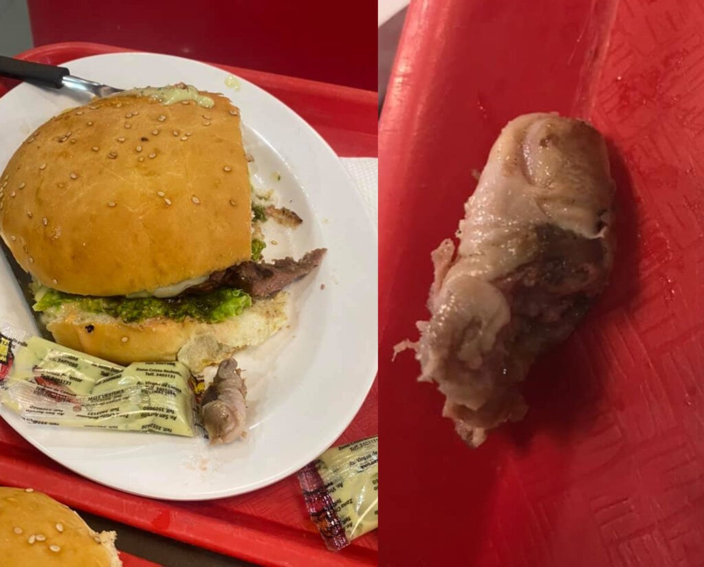 Confirman que dedo encontrado en hamburguesa es real | RTA Noticias