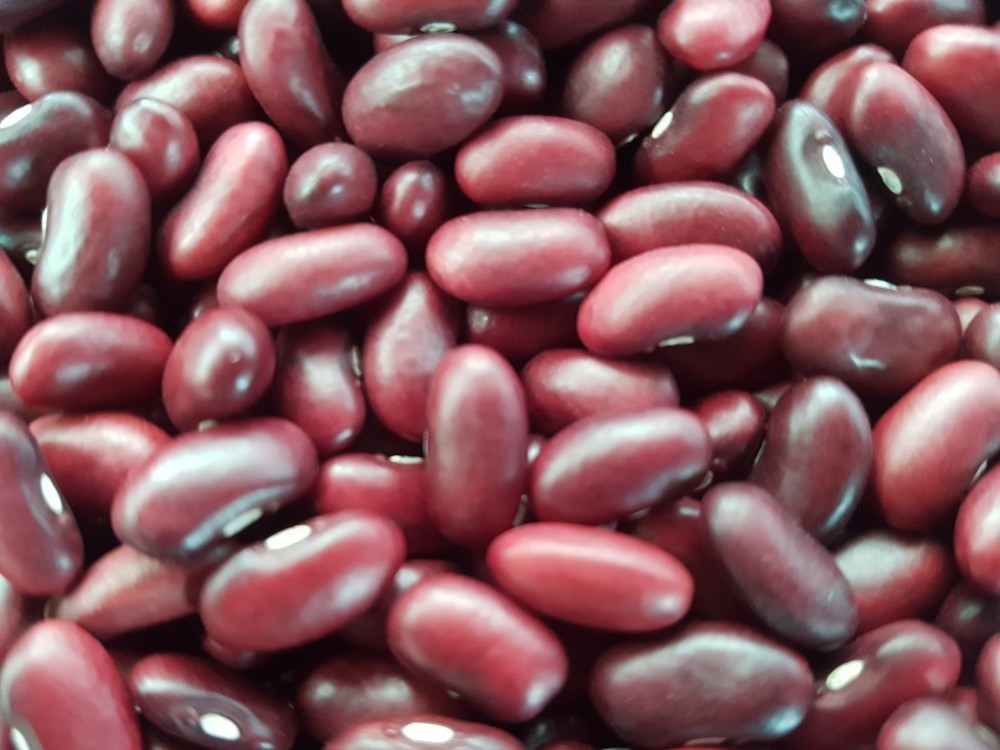 Proyecto de fríjol biofortificado en el Cesar | RTA Noticias