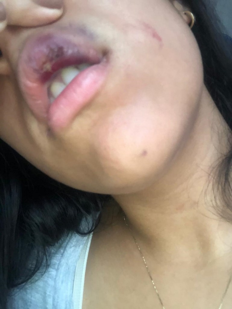 La otra cara del nuevo Rey Vallenato ¿maltratador? | RTA Noticias