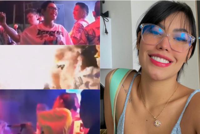 Ana del Castillo muestra sus quemaduras por el incidente | RTA Noticias
