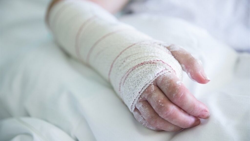 Hombre le prende fuego a su pareja, por no lavar los platos | RTA Noticias