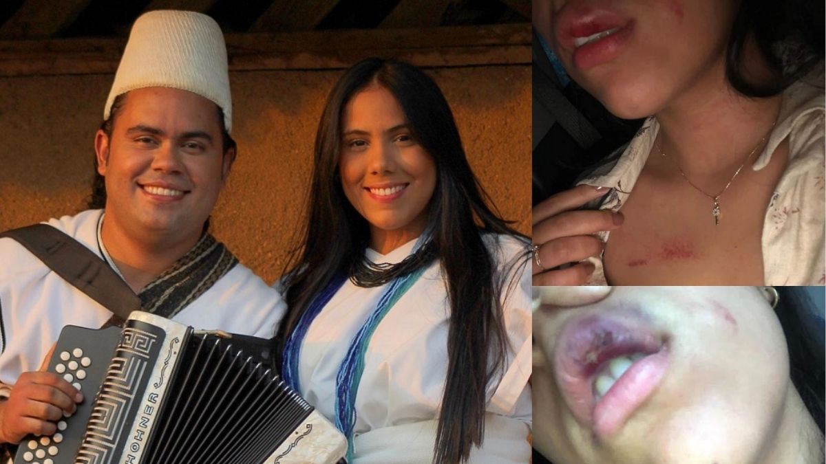 Foto de la otra cara del rey vallenato