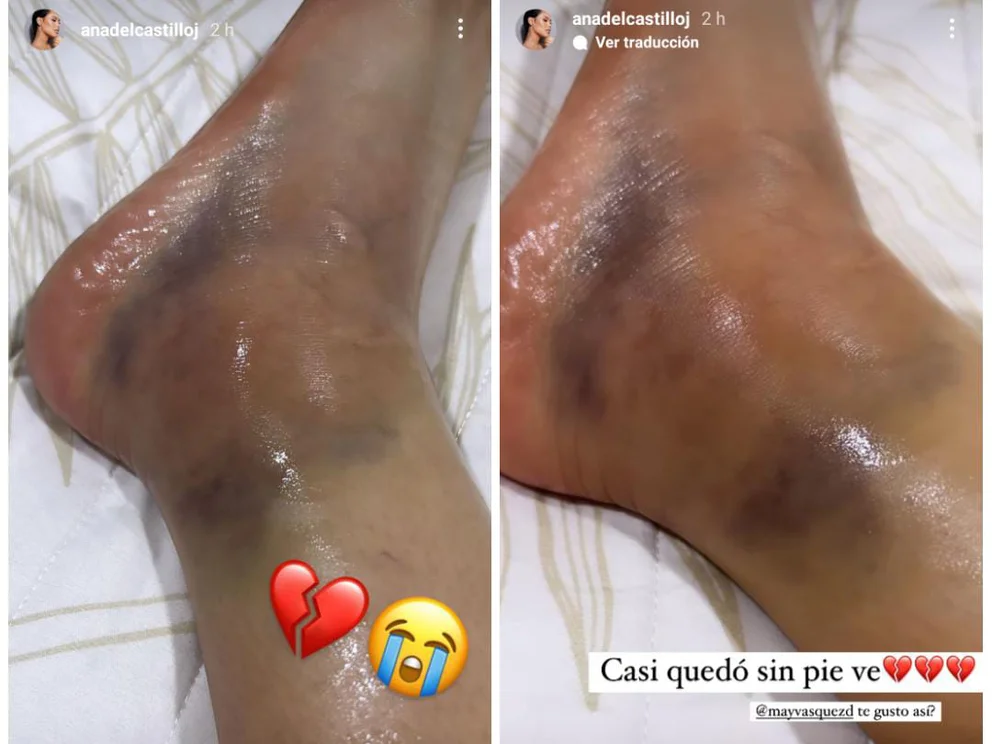 Conozca que le pasó a Ana del Castillo | RTA Noticias