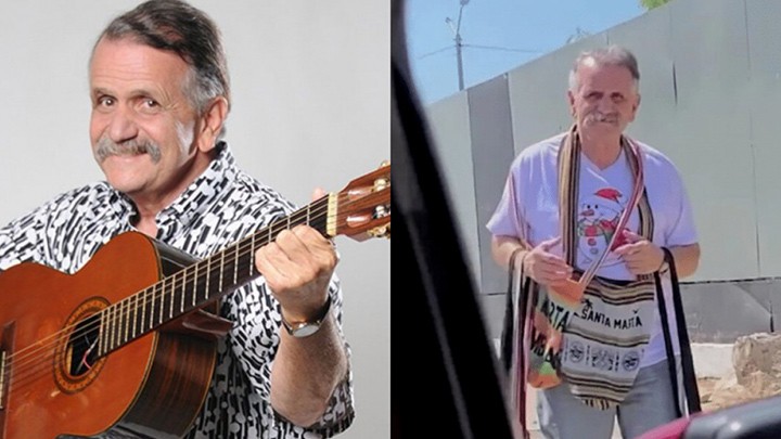 Esto dijo Caracol Televisión sobre el "hombre caimán" | RTA Noticias