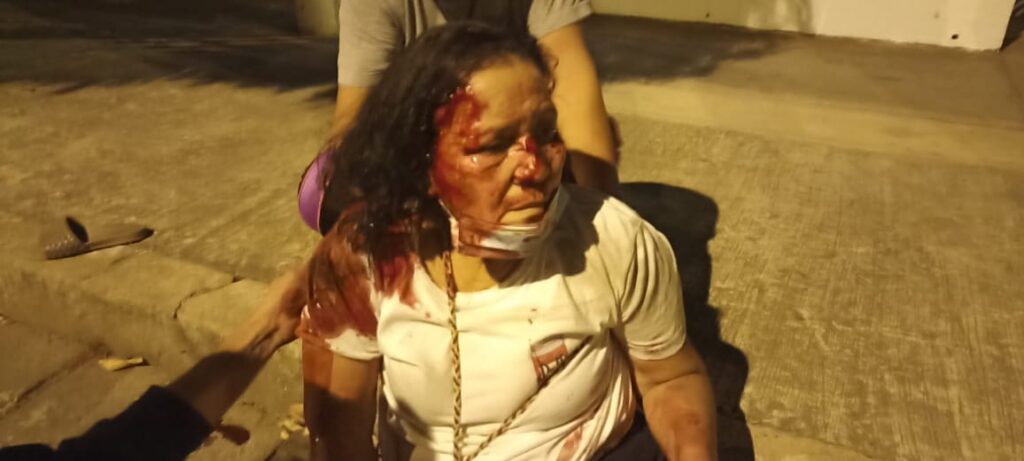 Cantante Vallenato atropelló a una pareja en el barrio La Granja | RTA Noticias