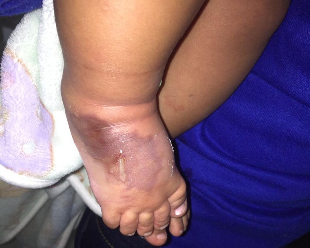 Madre denuncia que por negligencia de médicos su bebé falleció | RTA Noticias