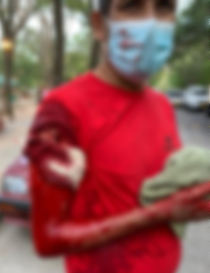 Taxista fue apuñalado al oponerse a un atraco en Valledupar Taxista fue apuñalado al oponerse a un atraco en Valledupar | RTA Noticias