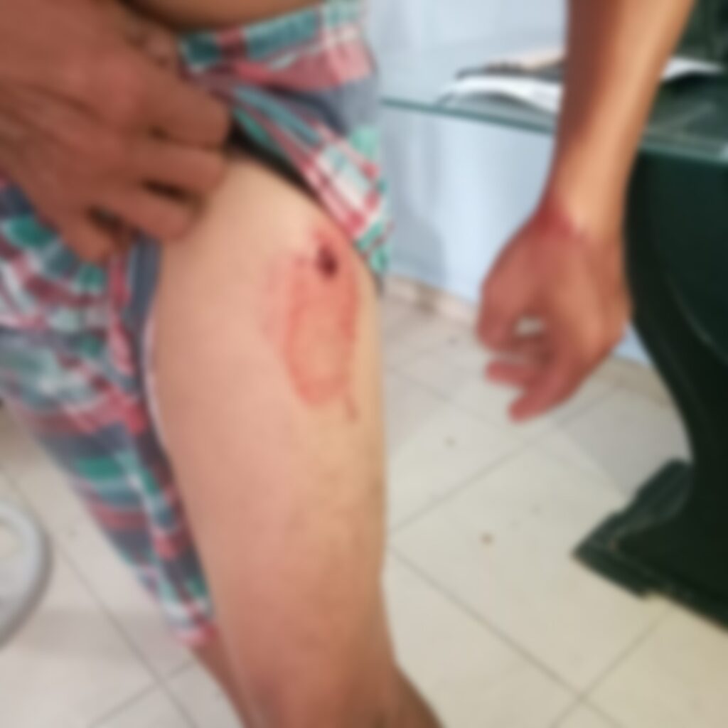 Atentan contra profesor de patinaje en el barrio El Carmen | RTA Noticias