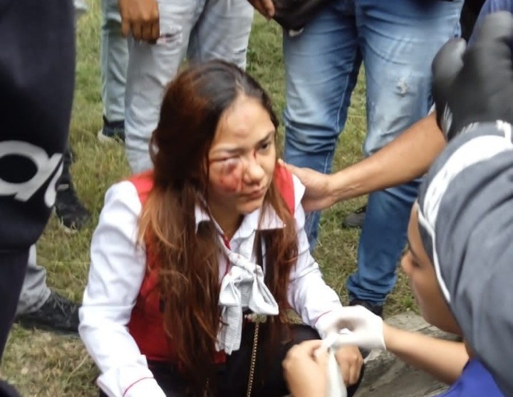 Mujer quedó herida al caer de una moto en medio de atraco WhatsApp-Image-2022-06-09-at-6.00.23-PM