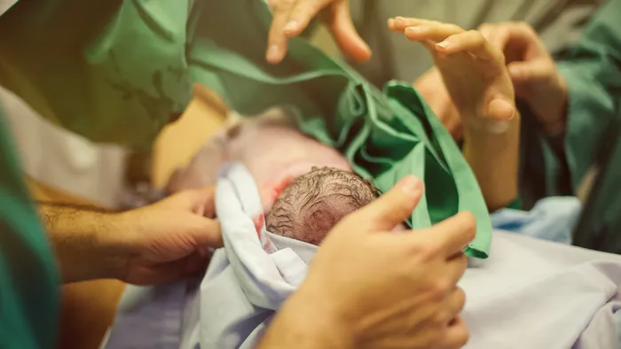 Bebé nace con cuatro brazos y cuatro piernas Nace-bebe-con-cuatro-brazos-y-cuatro-piernas-en-India