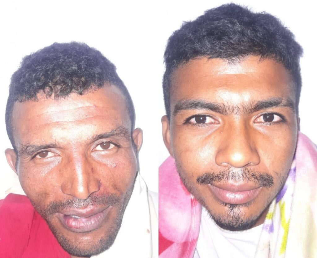 Recolector de mango fue herido a bala en Valledupar Recolector de mango fue herido a bala en Valledupar | RTA Noticias