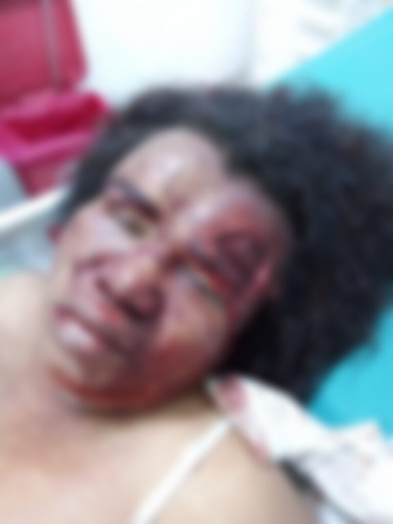 Lo capturan por presuntamente agredir a su pareja | RTA Noticias