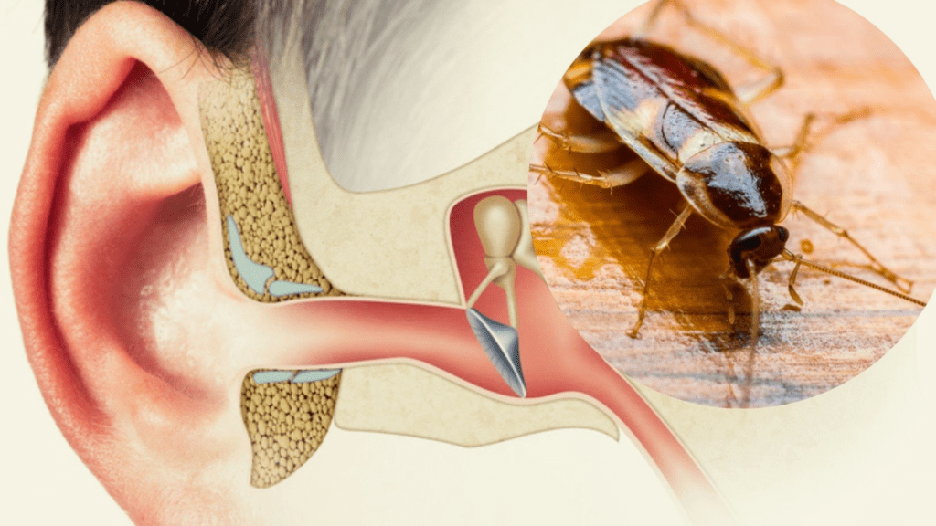 A hombre le extrajeron una cucaracha del oído | RTA Noticias