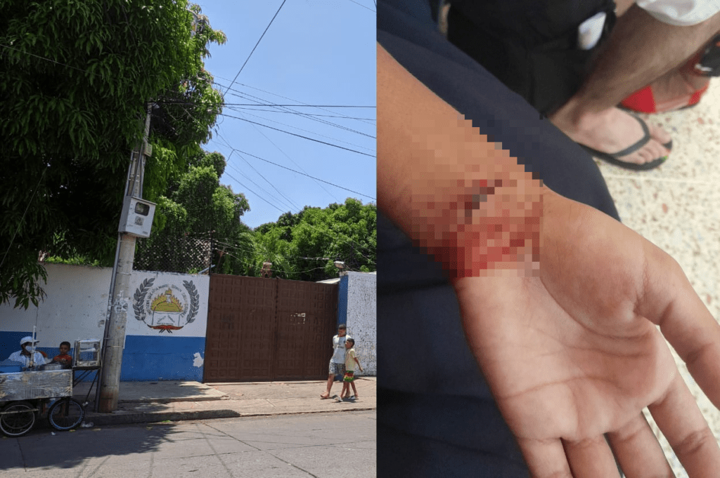 Niña es agredida con arma blanca en colegio de Valledupar | RTA Noticias