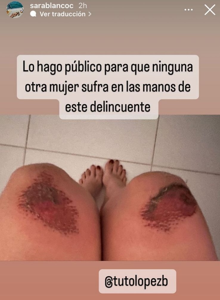 Denuncian a rey vallenato Tuto López por tentativa de feminicidio Denuncian a rey vallenato Tuto López por tentativa de feminicidio | RTA Noticias