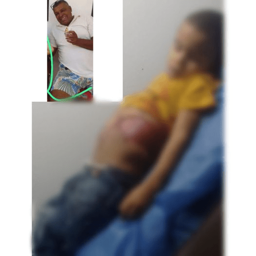 Trágico accidente en Fonseca deja un niño muerto y 18 heridos | RTA Noticias