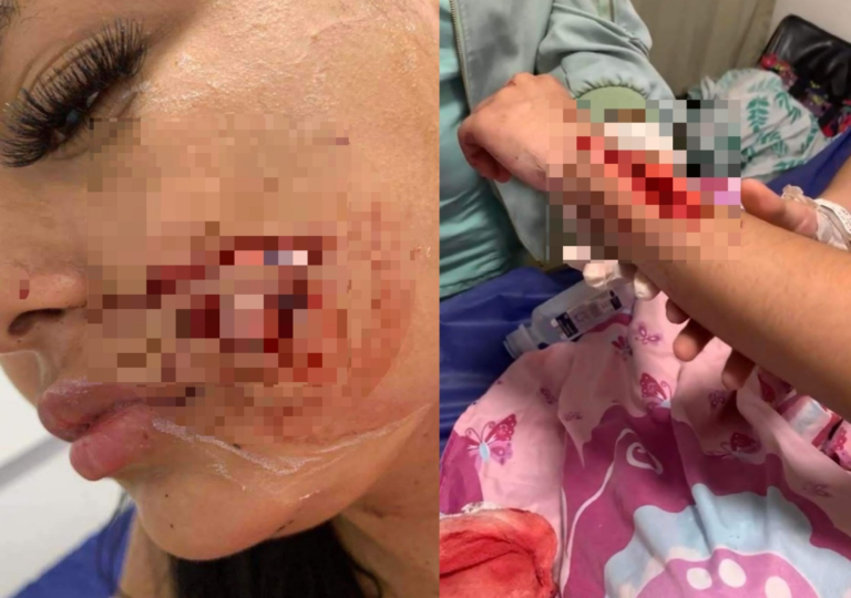 Con pico de botella fueron agredidas tres mujeres en Valledupar image-194