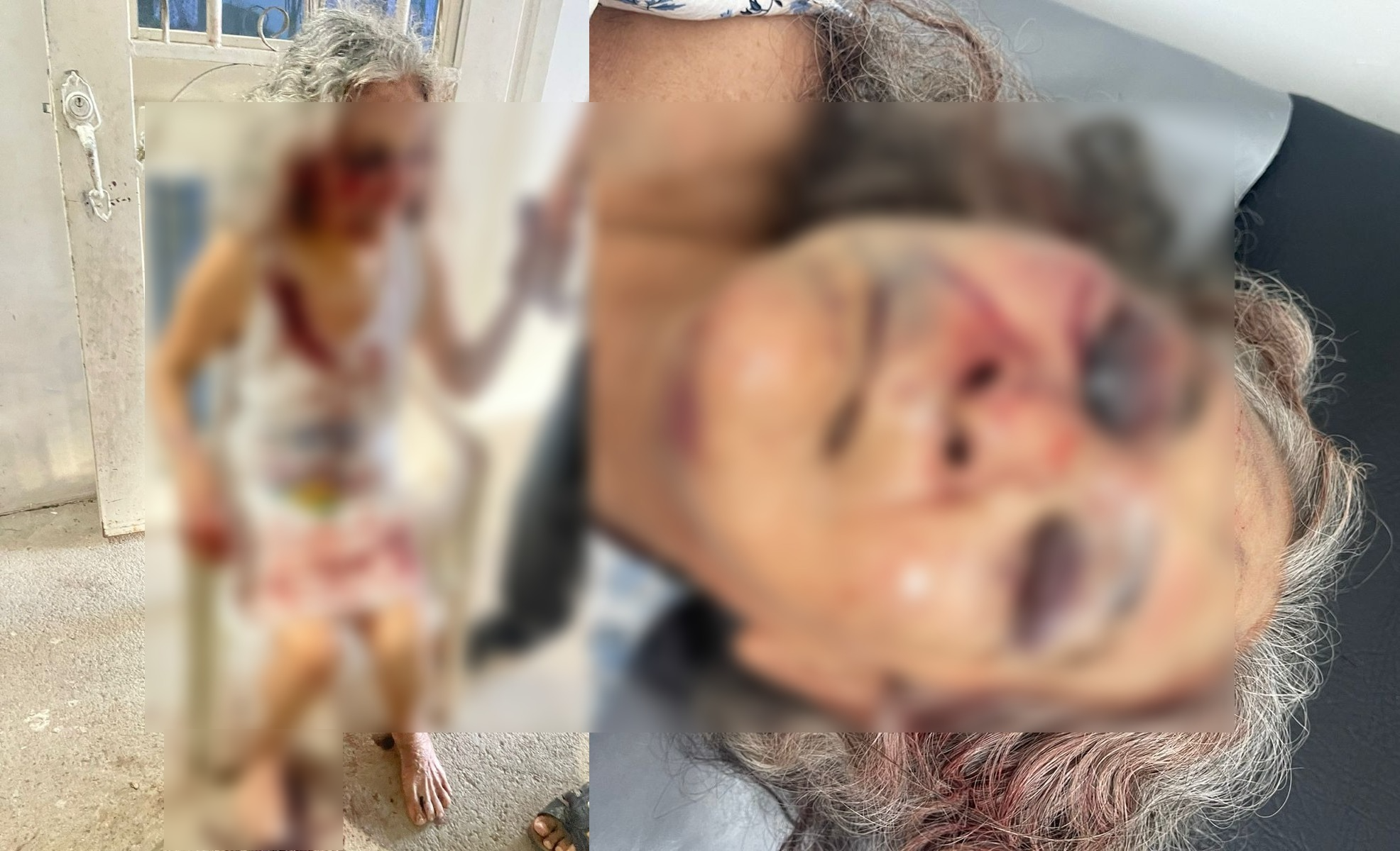 Adulta mayor fue brutalmente golpeada tras un atraco image-228