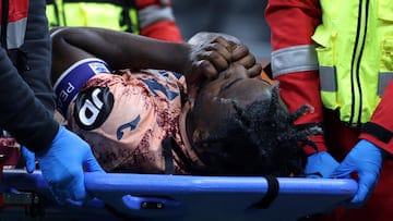 Duván Zapata, baja por lesión tras enfrentarse al Inter de Milán Imagen de WhatsApp 2024-10-07 a las 14.39.20_5b8e2d02