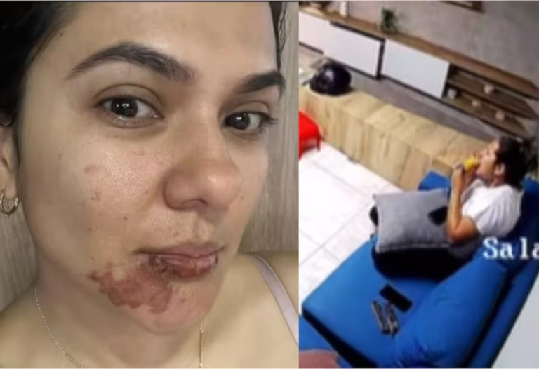 Empanada explota y lesiona a una mujer en el rostro image