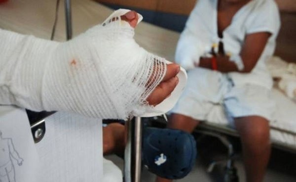 QUEMADOS POLVORA CESAR