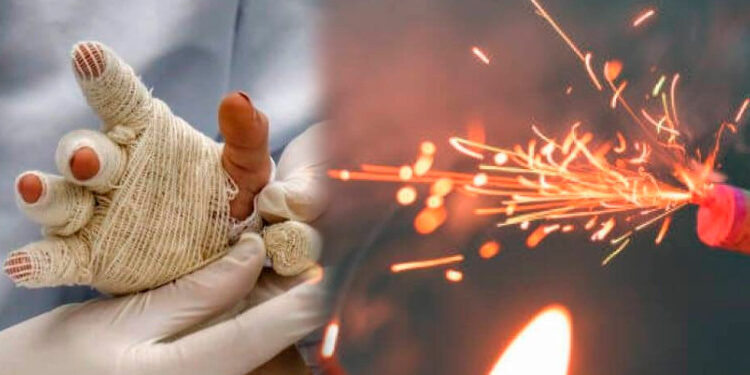 QUEMADOS POR POLVORA